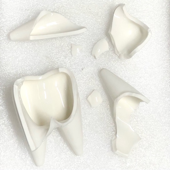 Kintsugi Planter Ceramic Tooth Gold Crack Dental Art Growth Gift Dentist - Picture 3 of 13